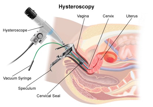 Endoscopy & Office Hysteroscopy